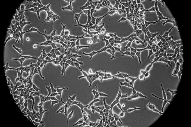 Immoratlized Cell Lines